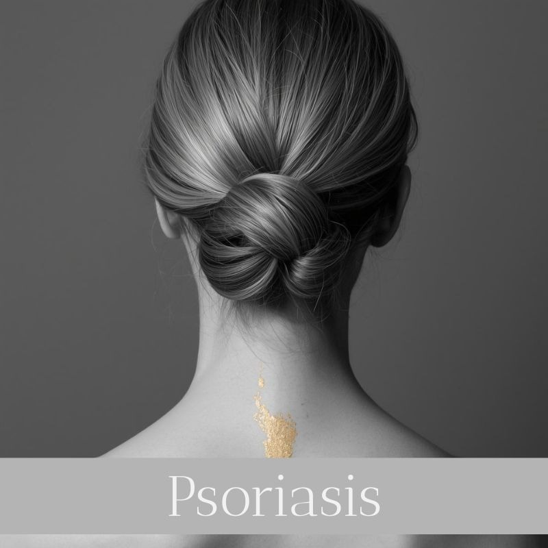 ulta online para la psoriasis