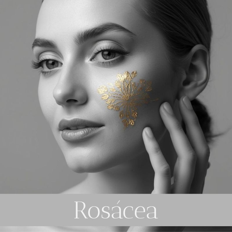Consulta online para la rosacea