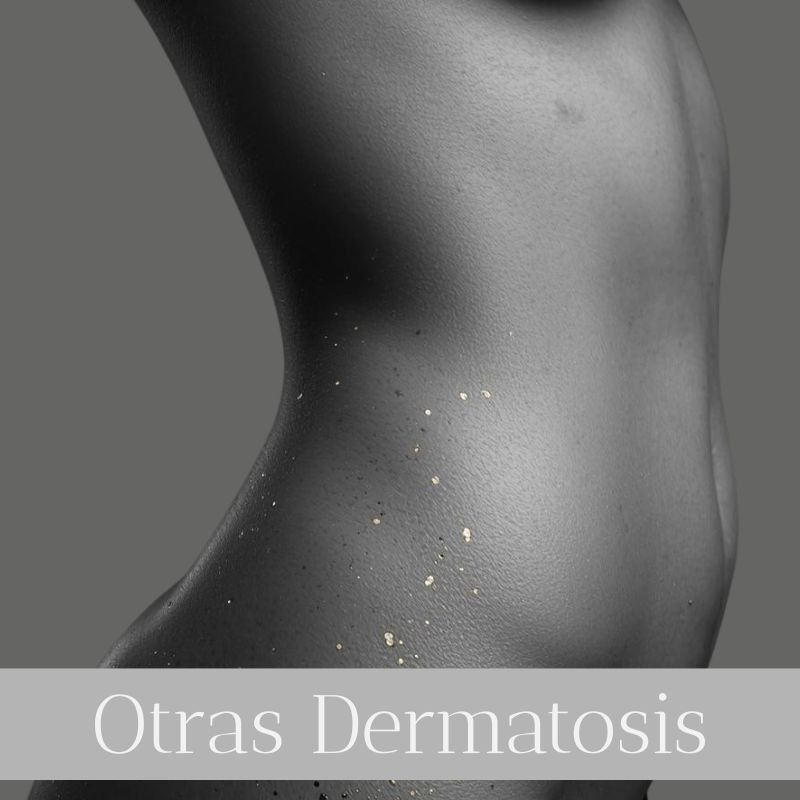 ulta online para la dermatosis